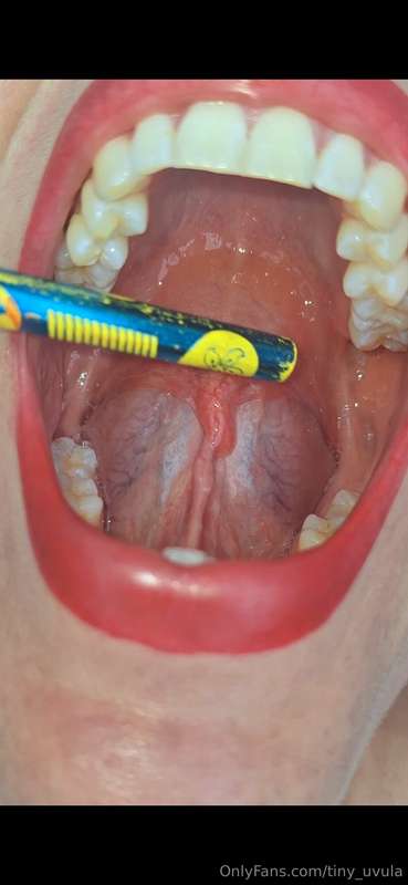 tiny_uvula image #0