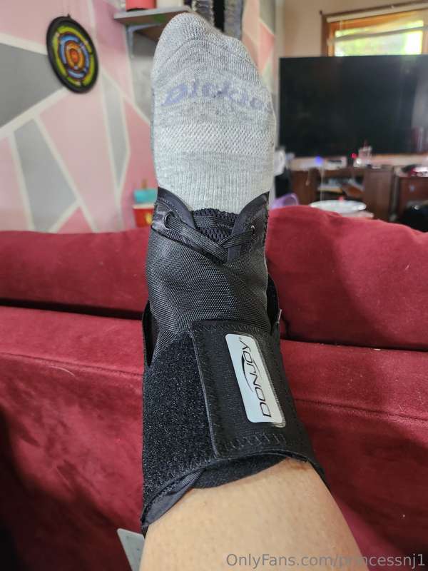 My poor foot so fat....damn sprained ankle