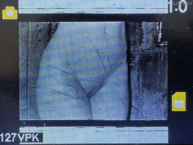 bb.apathy image #0
