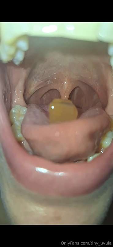 tiny_uvula image #1