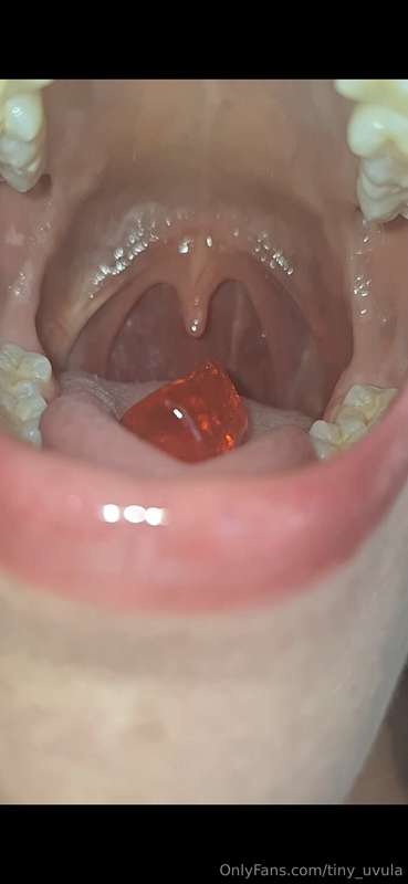 tiny_uvula image #0