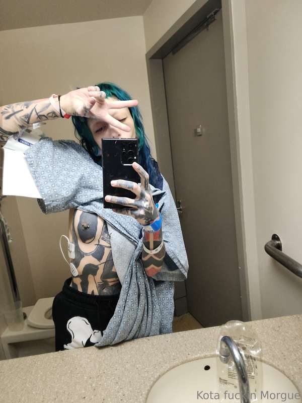 I'm alive 🥹 went into surgery last night and don't know the ..