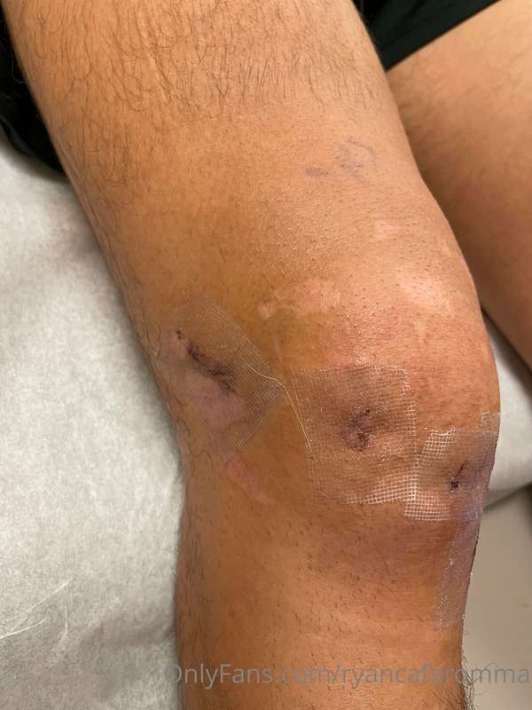 Knee rehab: I haven’t been able to do much since my knee jus..