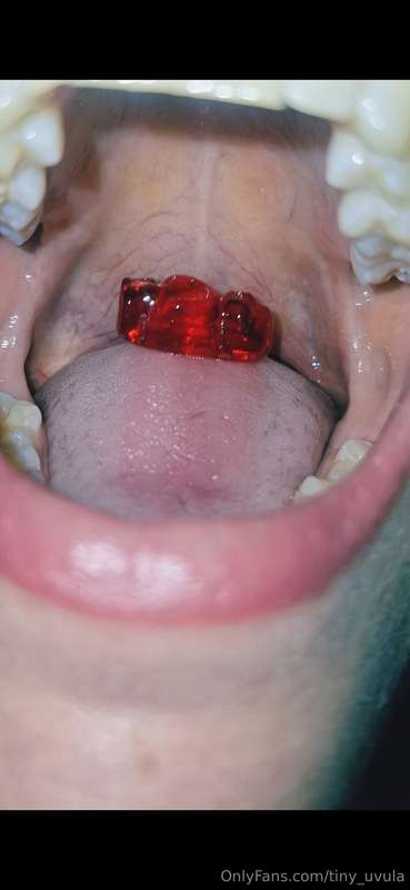 tiny_uvula image #0