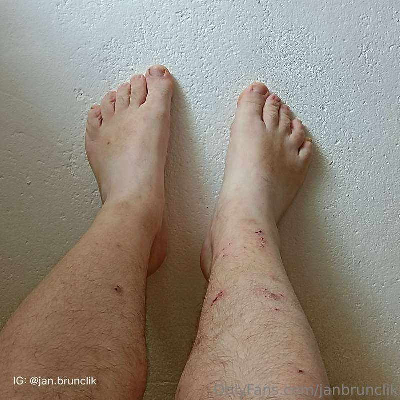 My legs