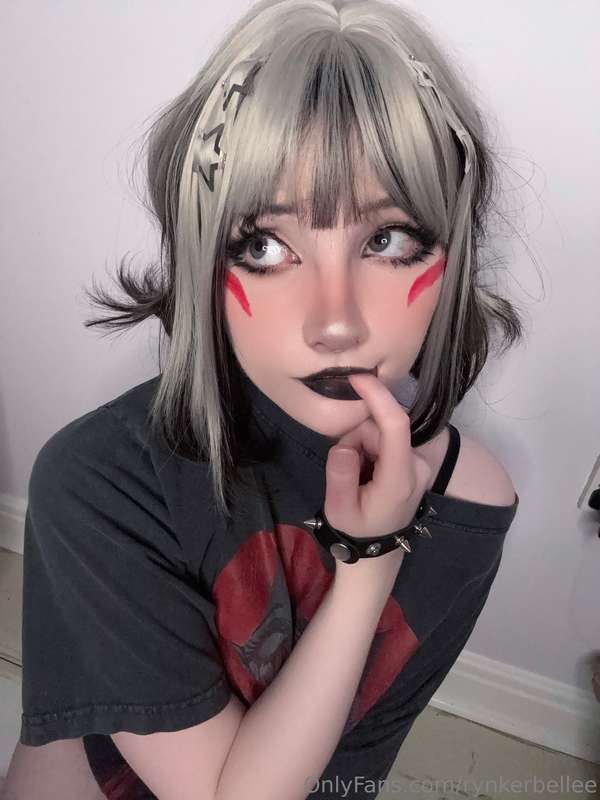 Hii everyone!! surgery went well and back to making content ..