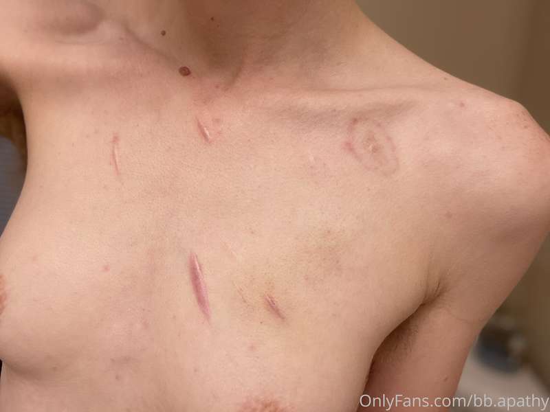 lil bite mark 👹

i just love having physical evidence that s..