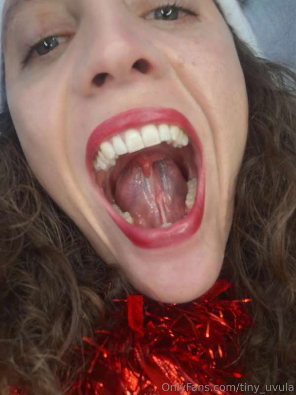 tiny_uvula image #1