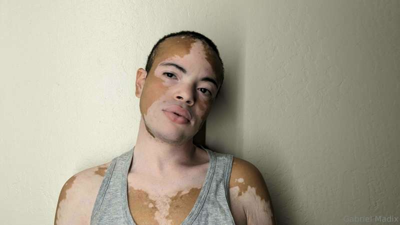 media