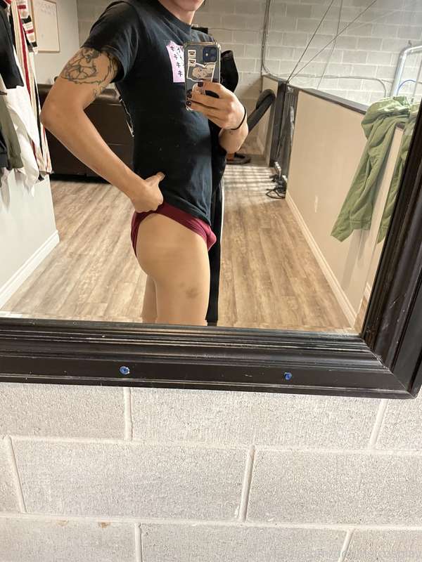Just a little bruised up