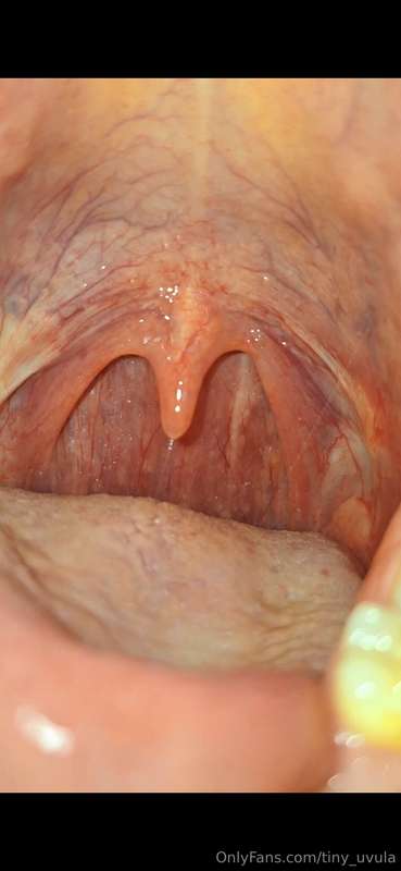 For the new comers...VERY closeup views of my uvula and the ..