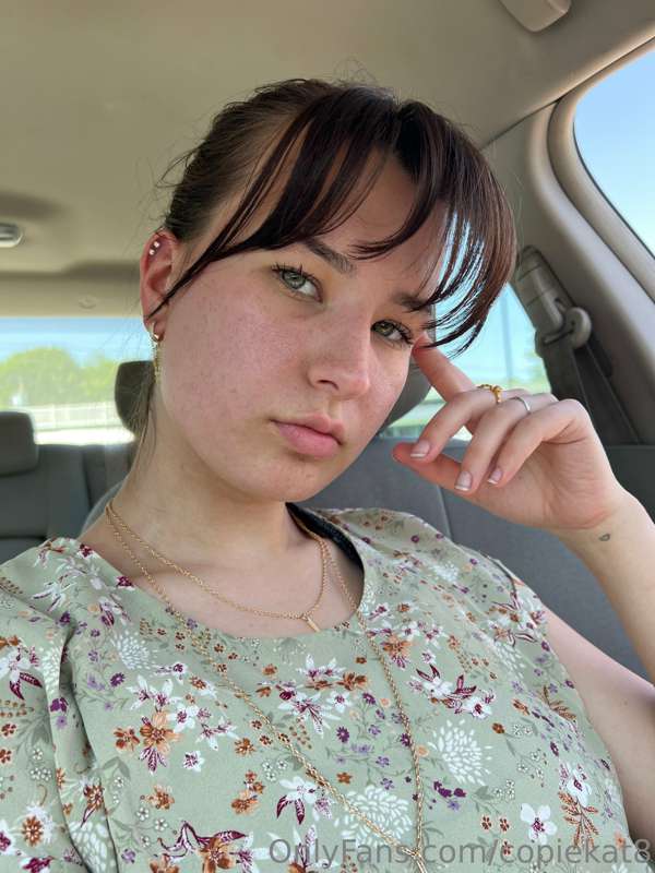 Summer freckles have made their appearance