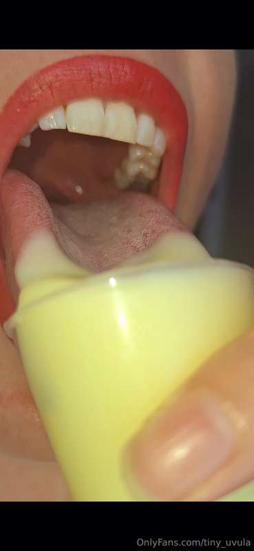 tiny_uvula image #1