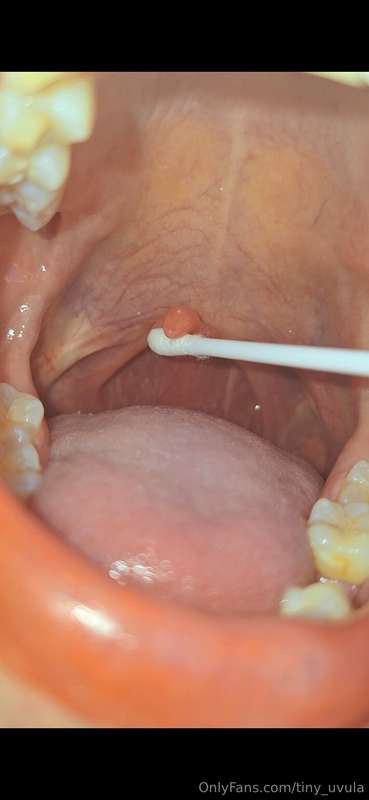 tiny_uvula image #0