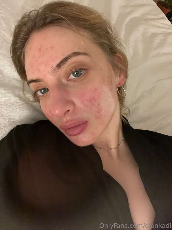 dionkadi