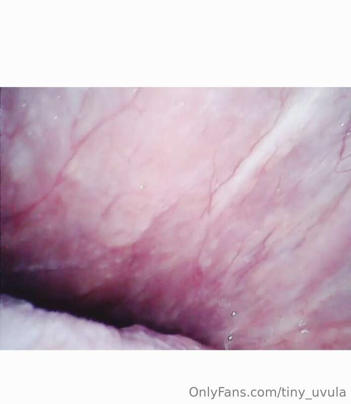 tiny_uvula image #0
