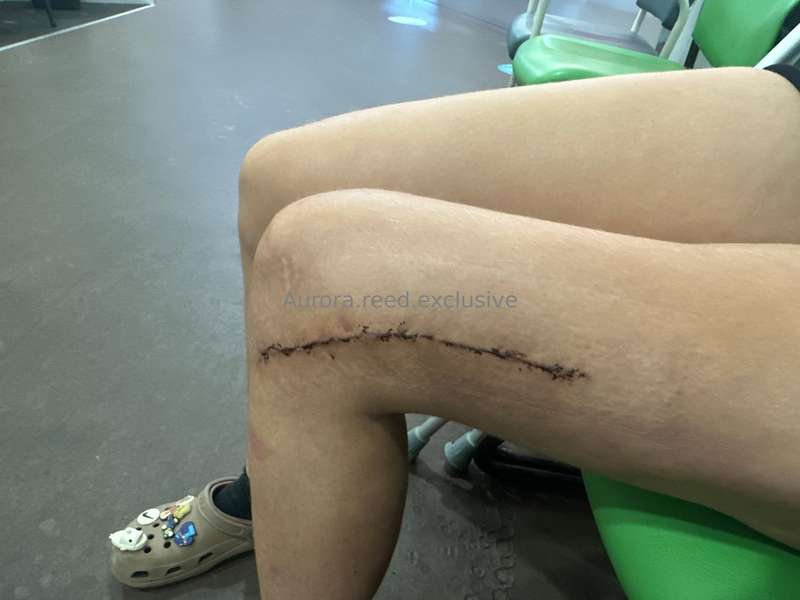 aurora.reed.exclusive