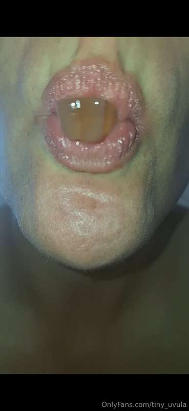 tiny_uvula image #0