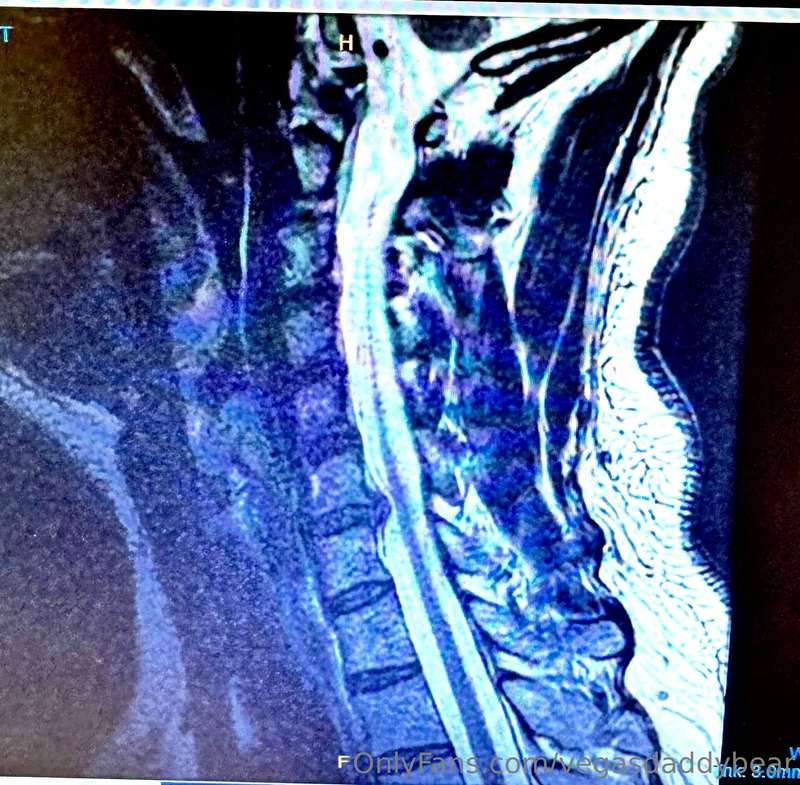 I’m out of commission for a few weeks. Been dealing with a b..