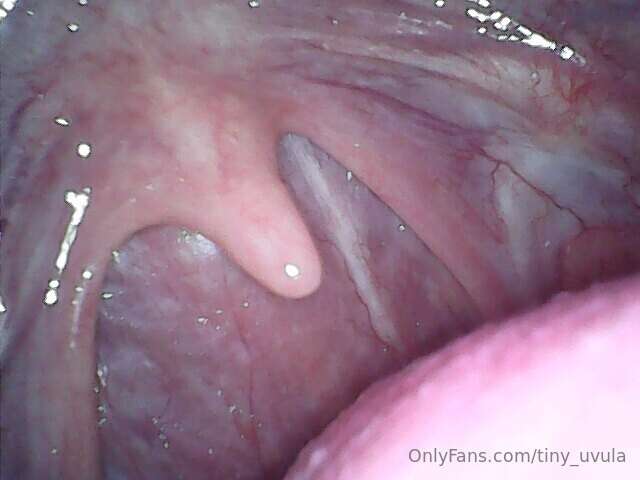 tiny_uvula image #0