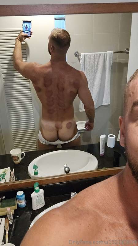 great cupping massage, especially the hickey between the but..