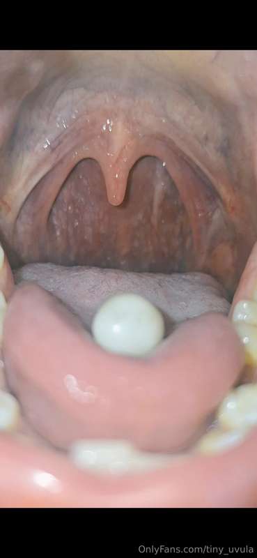 tiny_uvula image #1