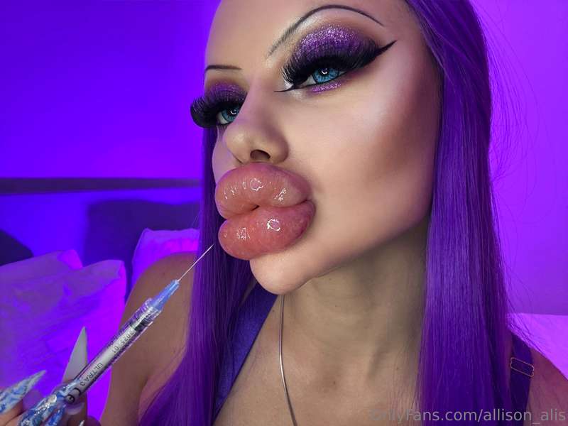 Watch this swollen bimbo lips new video 💜💦