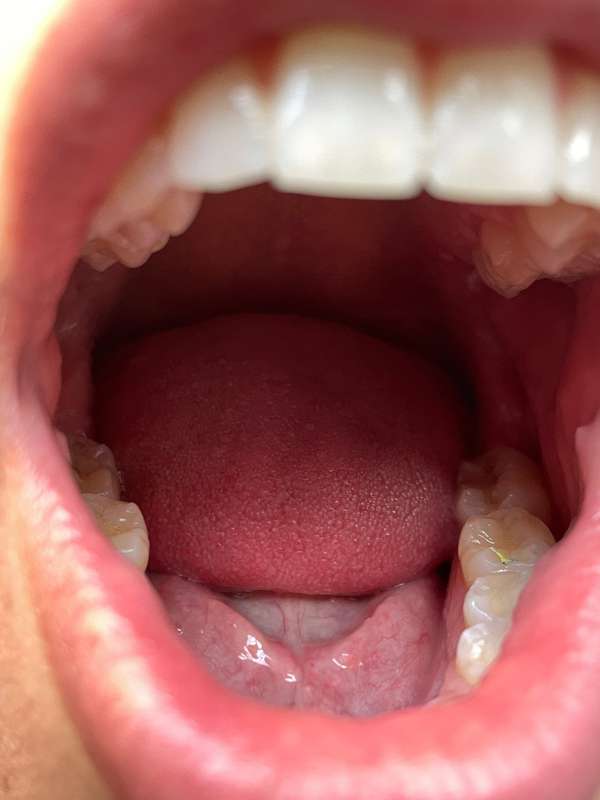You are no match for my giant teeth. Of course you're fine n..