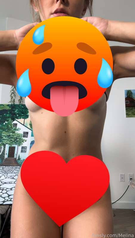 DM