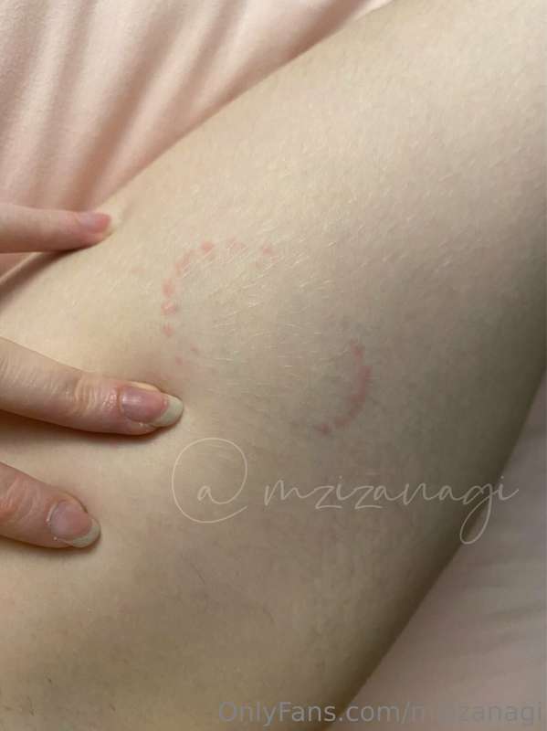 i love this bite mark on my thigh 🤤💗💗💗 so pretty
