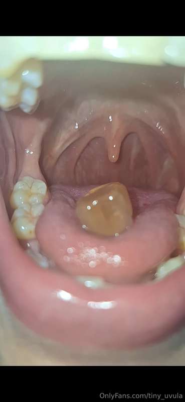 tiny_uvula image #0