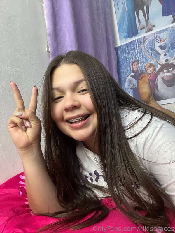kikisbraces