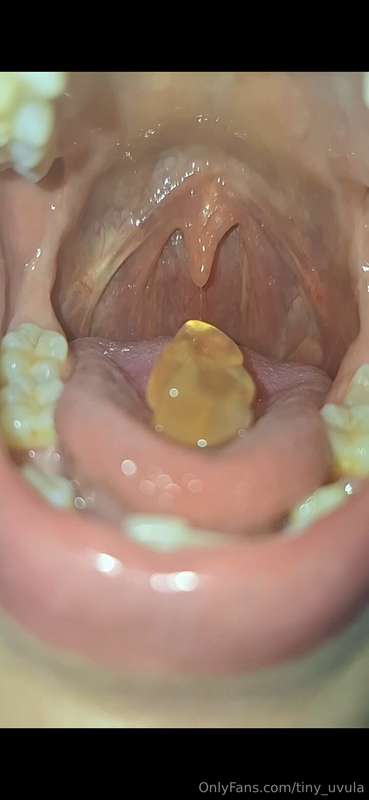 tiny_uvula image #0