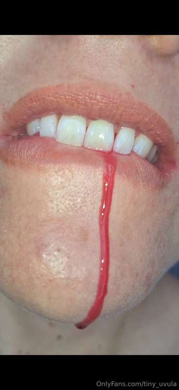 tiny_uvula image #1