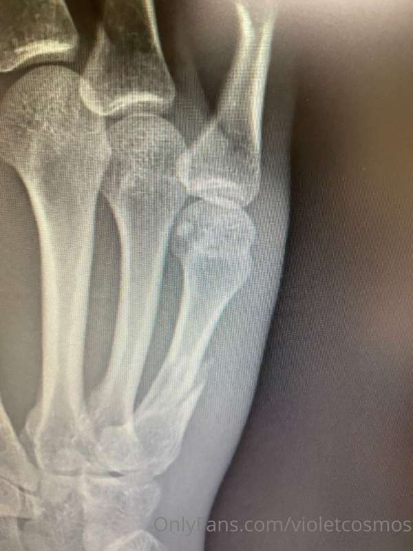 Omgoodness I’ve been so swamped since I broke my hand! And I..