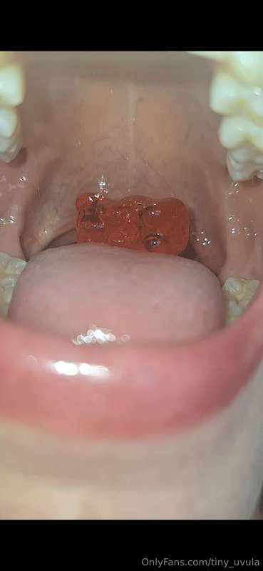 tiny_uvula image #1