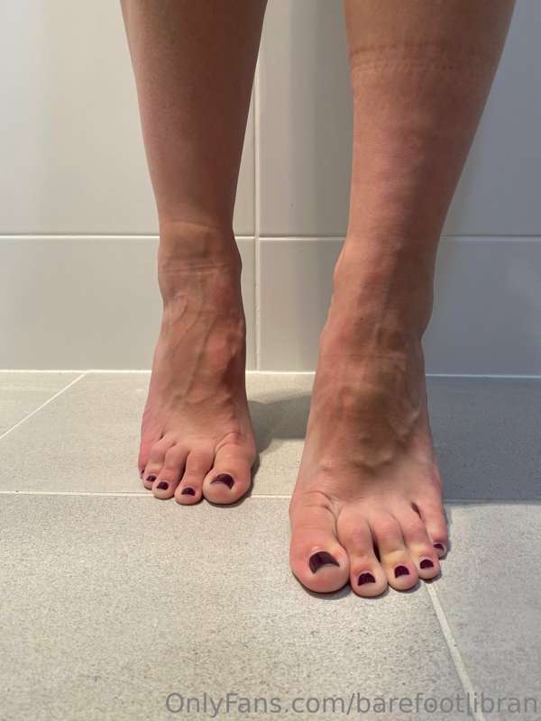 Never seen elsewhere… veins, sock marks, toes. Plenty more a..