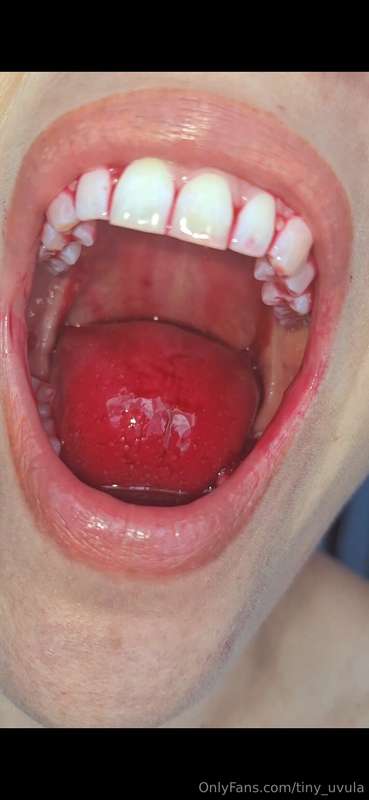 tiny_uvula image #0