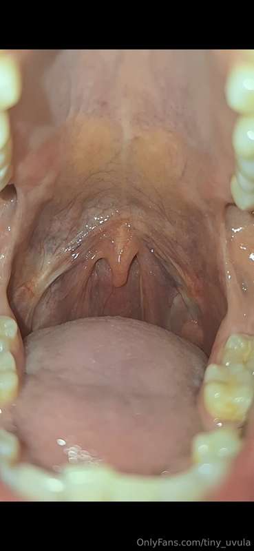 8min slow motion video of closeup uvula views and movement....