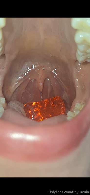 tiny_uvula image #2