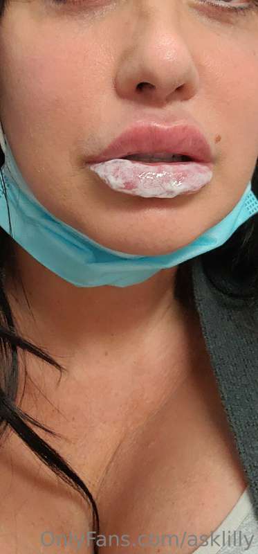 It was $1000 just for botox and 1ml filler so I will have to..