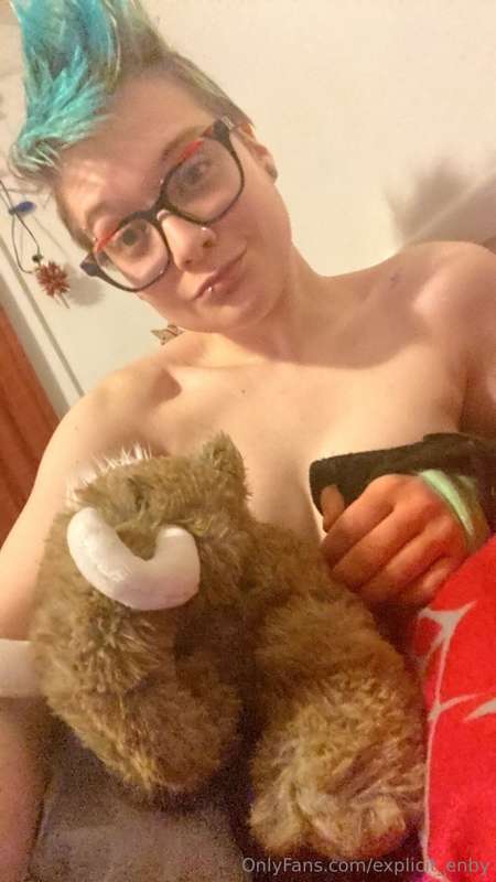 My arm is almost healed up again (for the most part). I got ..
