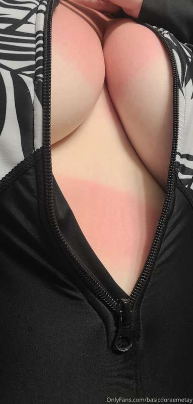 Sunburn is still pretty bad, sorry