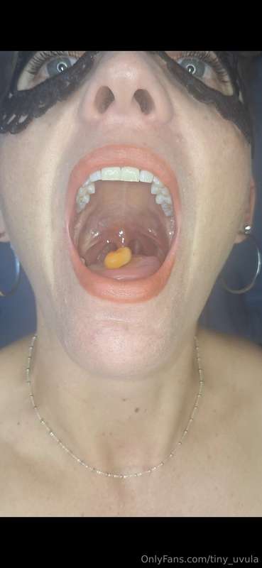 tiny_uvula image #1