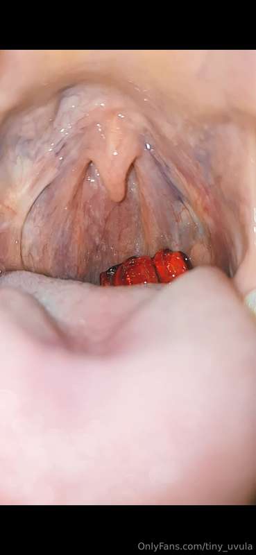 tiny_uvula image #1