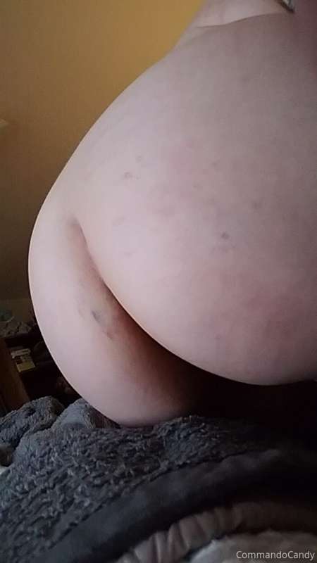 Sometimes... bruises happen 🥵🥵🍑🍑 | commandocandy Onlyfans Picture