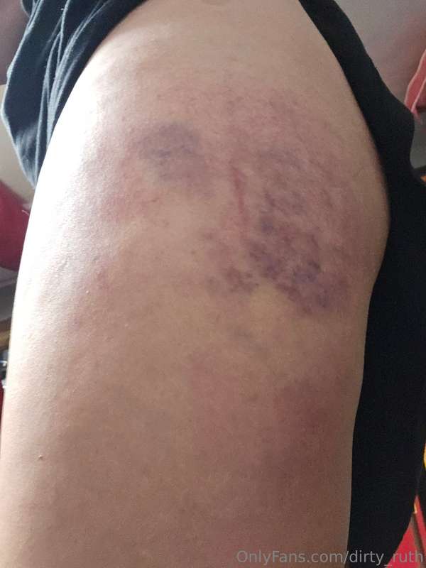 We went to a house party a couple of weeks ago, and I got th..