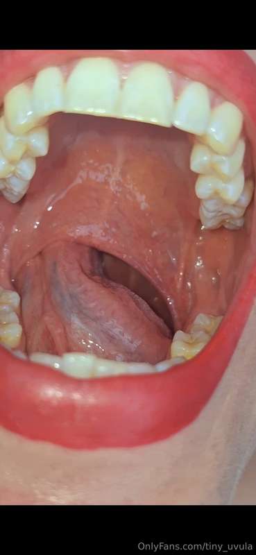 tiny_uvula image #0