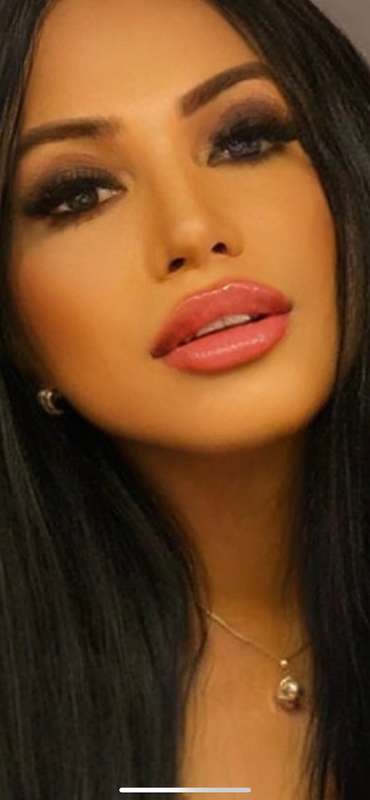 Kiss my 👄
