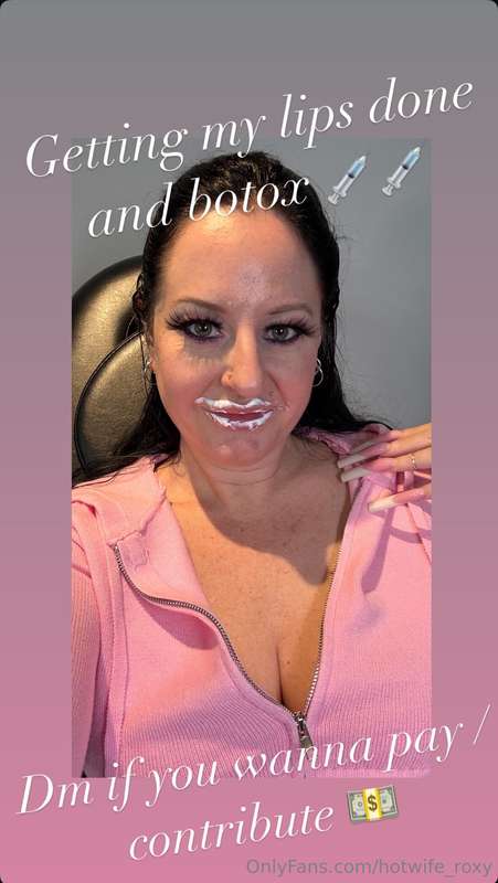 Dm me if you wanna pay/contribute for my lips and botox 💉💉. ..